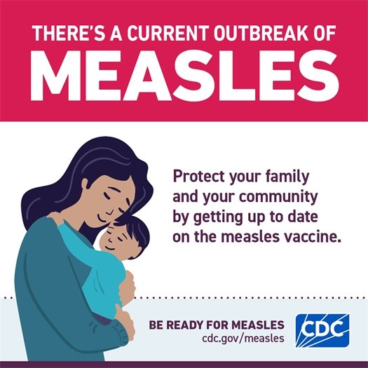 CDC Media Graphic - Measles Outbreak