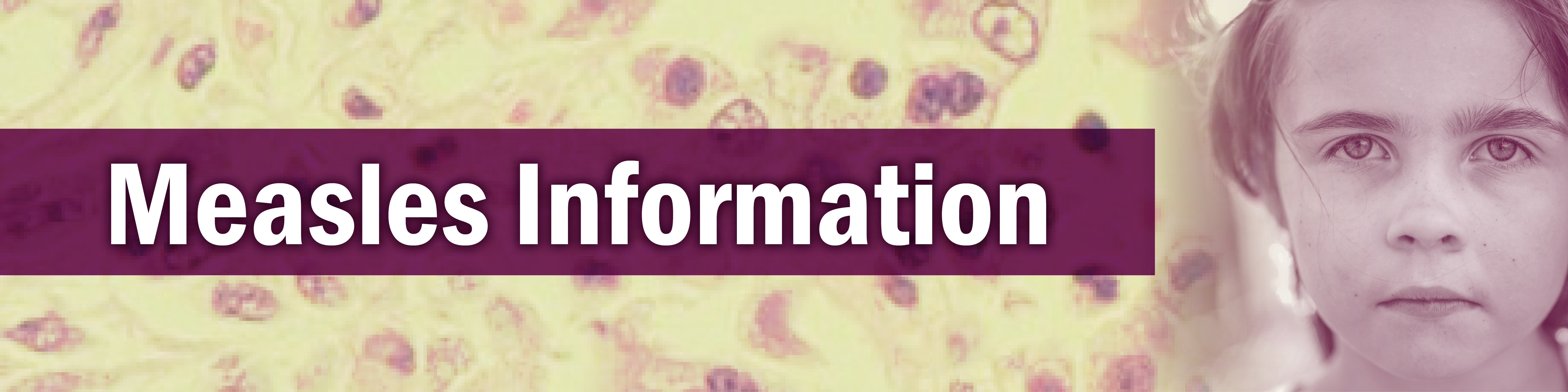 Measles Information